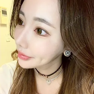 106日目の経過画像（3枚目）