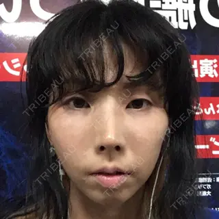 12日目の経過画像（2枚目）