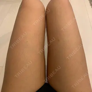3日目の経過画像（1枚目）