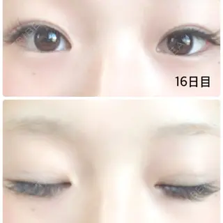 16日目の経過画像（1枚目）