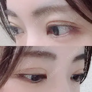 36日目の経過画像（2枚目）