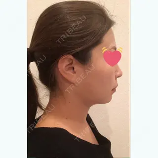 145日目の経過画像（2枚目）