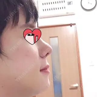 8日目の経過画像（1枚目）