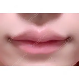 5日目の経過画像（1枚目）