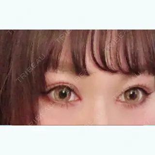 7日目の経過画像（2枚目）