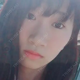 66日目の経過画像（2枚目）