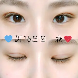 17日目の経過画像（1枚目）