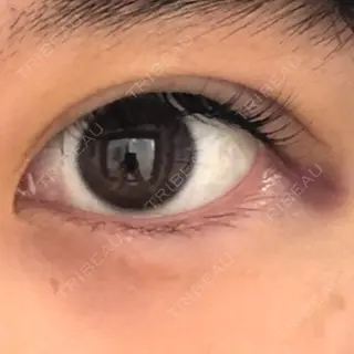 8日目の経過画像（1枚目）