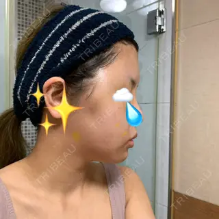 4日目の経過画像（3枚目）