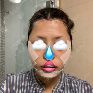 1日目の経過画像（1枚目）