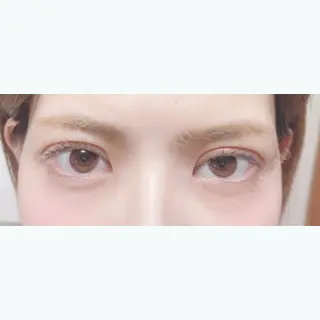 8日目の経過画像（1枚目）