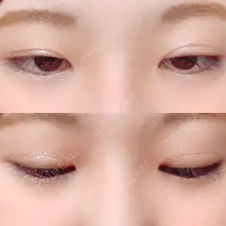 219日目の経過画像（2枚目）