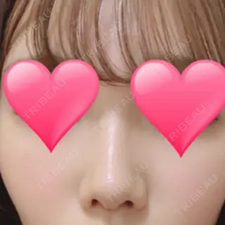 10日目の経過画像（1枚目）