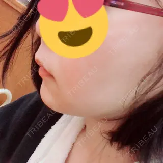 11日目の経過画像（2枚目）