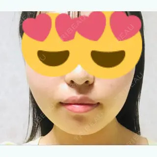 63日目の経過画像（1枚目）