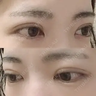 40日目の経過画像（2枚目）
