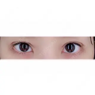 1日目の経過画像（1枚目）