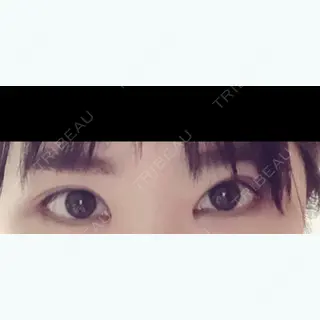 19日目の経過画像（1枚目）