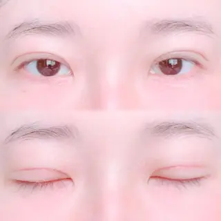 19日目の経過画像（1枚目）