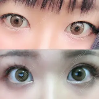 15日目の経過画像（1枚目）