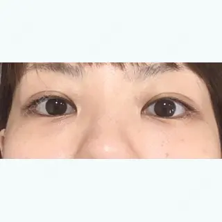 97日目の経過画像（1枚目）