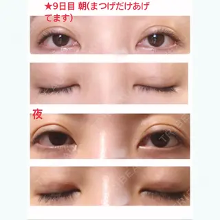 9日目の経過画像（1枚目）