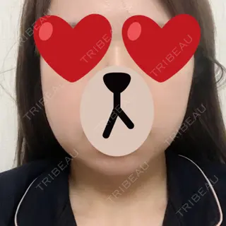 9日目の経過画像（1枚目）