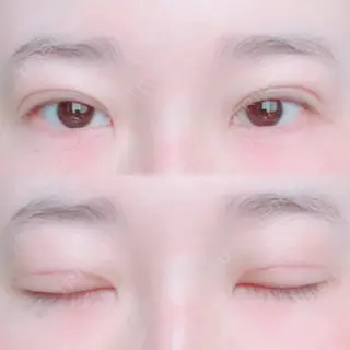20日目の経過画像（1枚目）