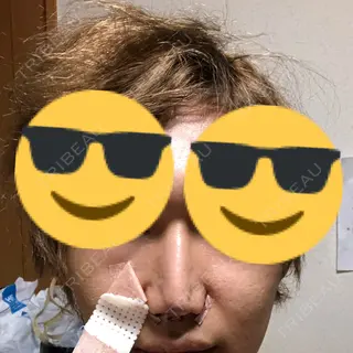 0日目の経過画像（2枚目）