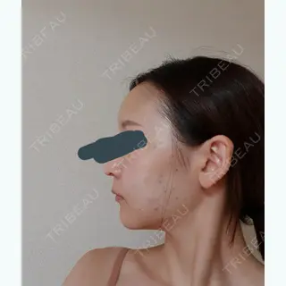 2日目の経過画像（2枚目）