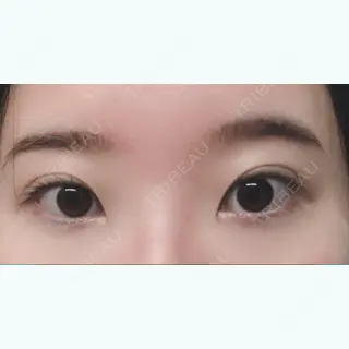 67日目の経過画像（1枚目）