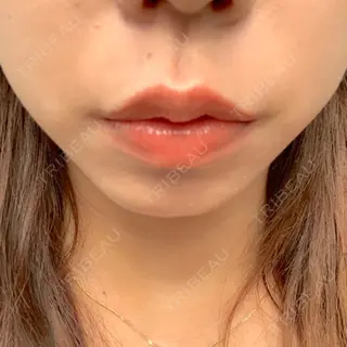 7日目の経過画像（1枚目）
