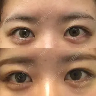 2日目の経過画像（2枚目）