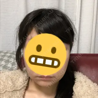 6日目の経過画像（1枚目）