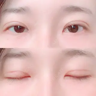 24日目の経過画像（1枚目）