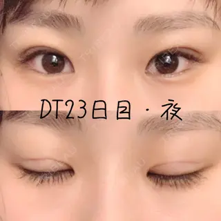 23日目の経過画像（1枚目）