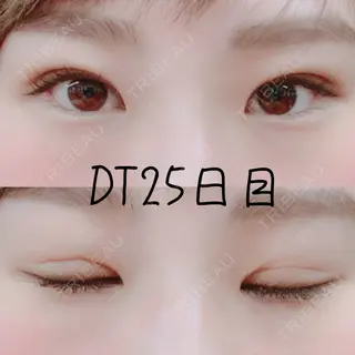 25日目の経過画像（1枚目）