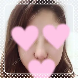8日目の経過画像（1枚目）