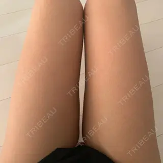 14日目の経過画像（1枚目）