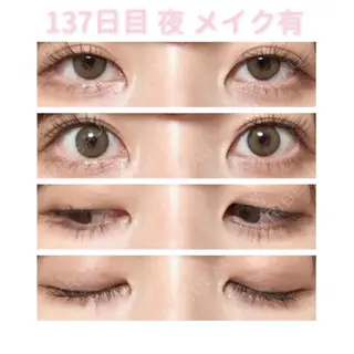 137日目の経過画像（1枚目）