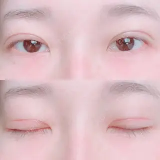25日目の経過画像（1枚目）