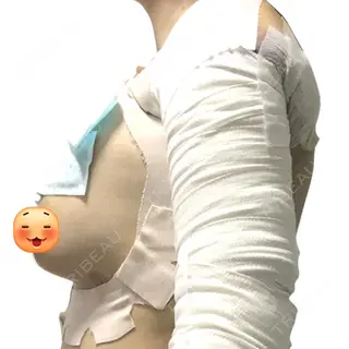 0日目の経過画像（3枚目）
