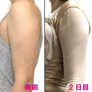 2日目の経過画像（1枚目）