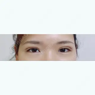 16日目の経過画像（1枚目）