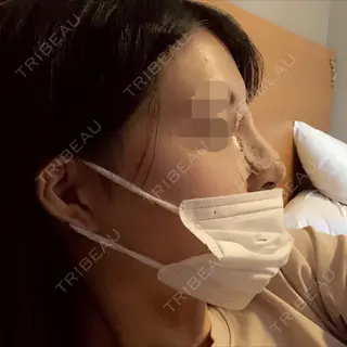 2日目の経過画像（2枚目）