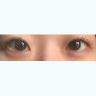 258日目の経過画像（1枚目）