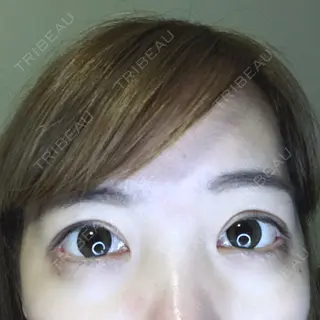 193日目の経過画像（1枚目）