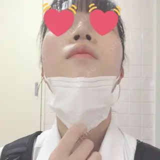 2日目の経過画像（2枚目）