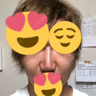 3日目の経過画像（1枚目）