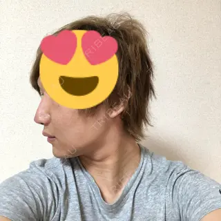 7日目の経過画像（2枚目）